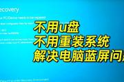 电脑蓝屏代码00007b（详解电脑蓝屏代码00007b，助你轻松排除故障）